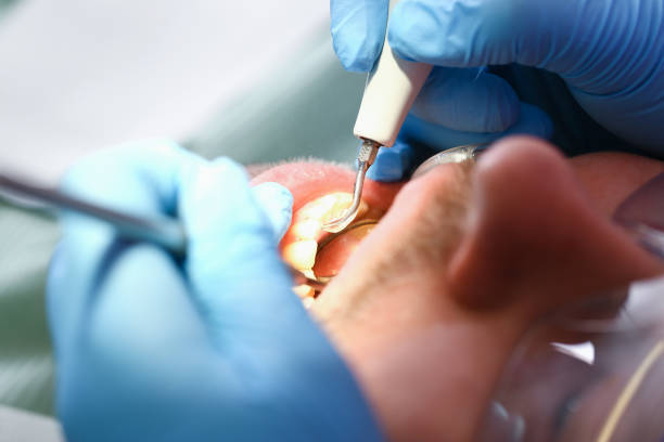 Best Pediatric Emergency Dentist in Middlebush, NJ