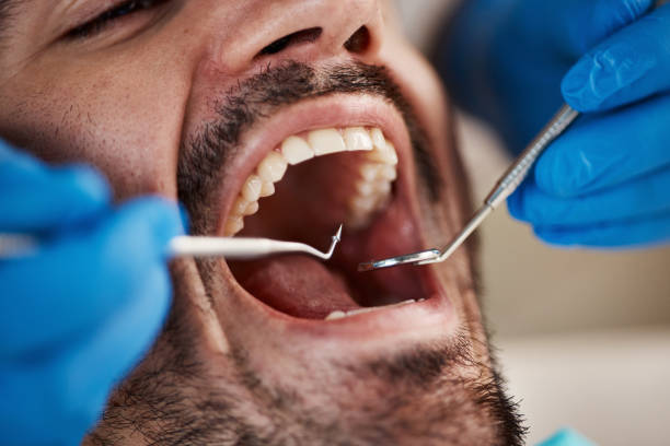 Best Pediatric Emergency Dentist in Middlebush, NJ