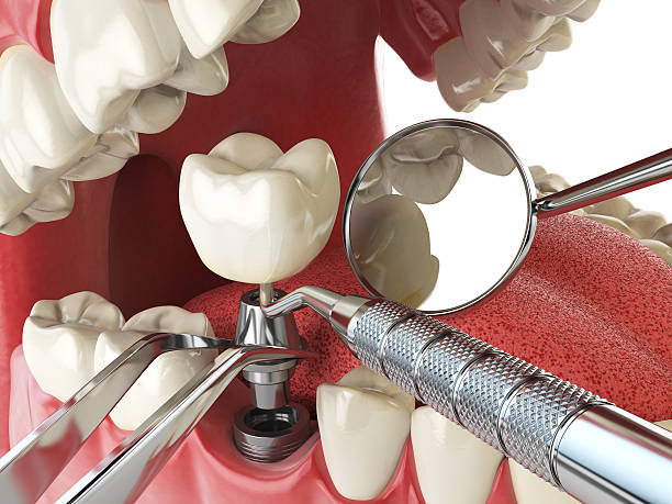 Best Emergency Dental Care for Trauma or Injury in Middlebush, NJ